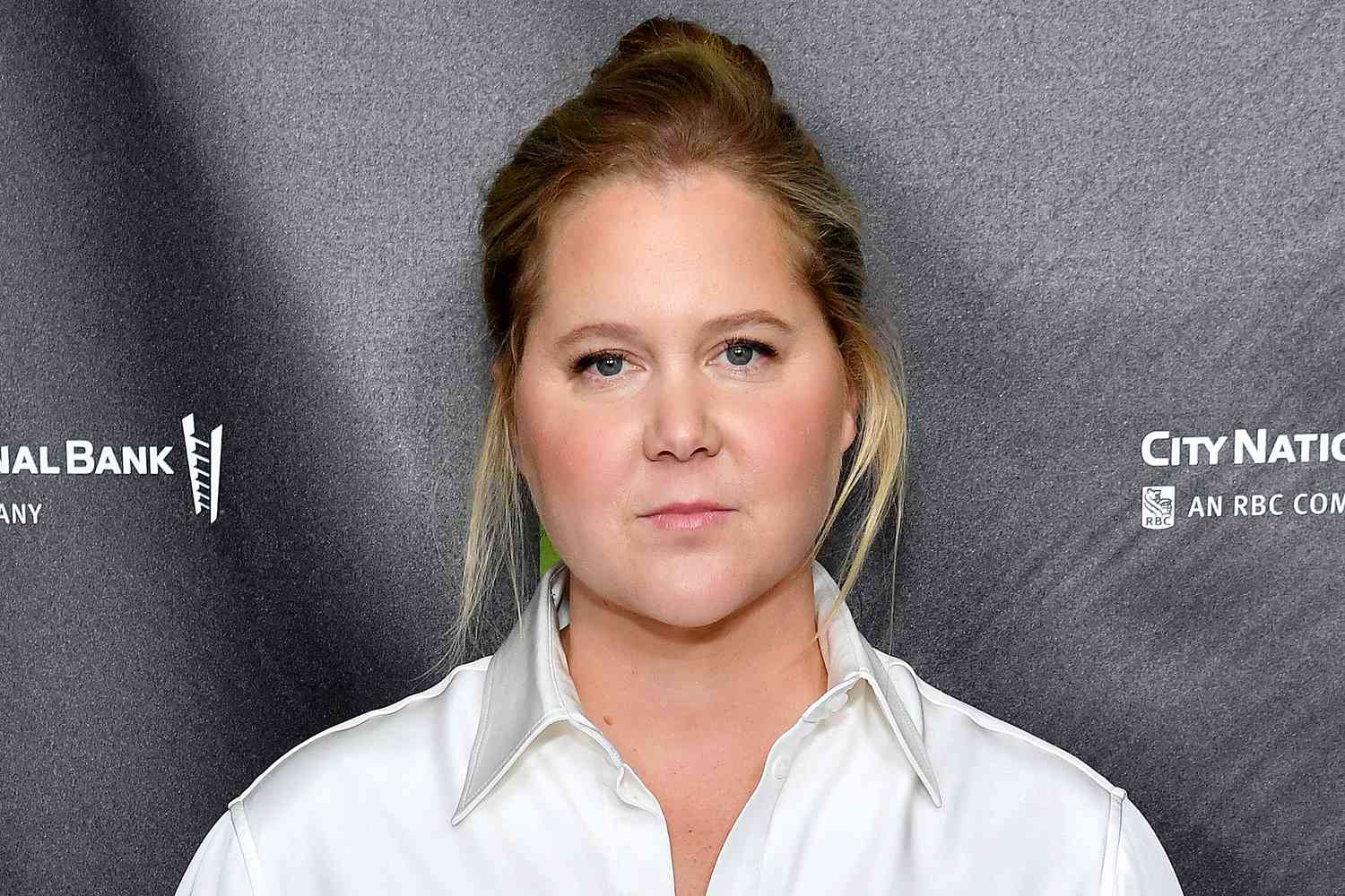 Amy Schumer diagnosed with Cushing syndrome